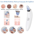 ASPIRA ELIMINA RIMUOVI PUNTI NERI PULIZIA VISO BRUFOLI A BATTERIE ACNE BELLEZZA