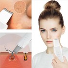 SPATOLA ULTRASUONI PULIZIA VISO PELLE ELIMINA PUNTI NERI 3 FUNZIONI MUYE 8815