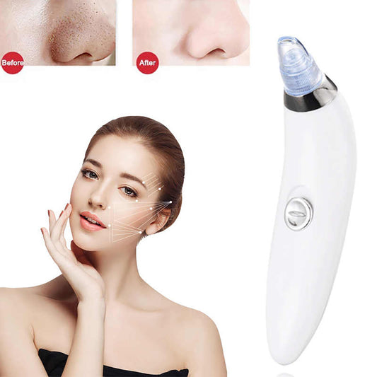 ASPIRATEUR POINTS NOIRS NETTOYANT VISAGE ACNÉ BOUTONS À BATTERIES BEAUTÉ