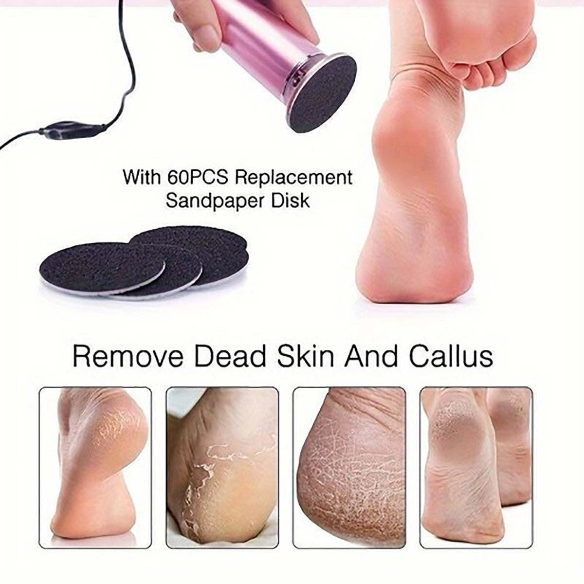 FRESA RIMUOVI CALLI ELETTRICO LEVIGATRICE PIEDI PEDICURE DURONI 60 DISCHI GH-99