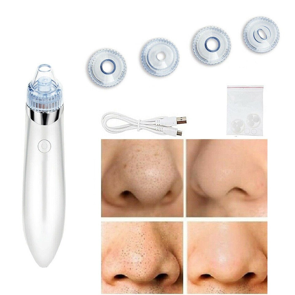 ASPIRATORE FACCIALE RIMOZIONE PUNTI NERI BRUFOLI PULIZIA VISO PORI NASALI XN8030